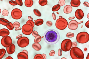 Blood cells showing anemia and iron deficiency