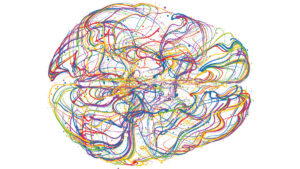 Illustration of brain and Parasubthalamic Nucleus